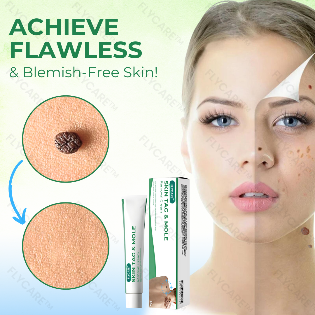 FLYCARE™ Skin Tag & Mole Removal Cream