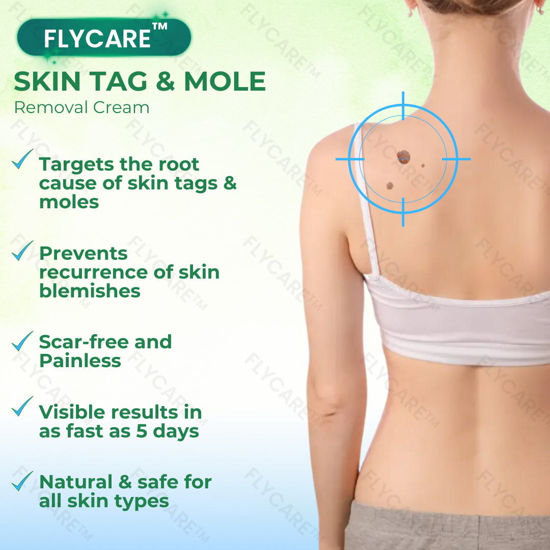 FLYCARE™ Skin Tag & Mole Removal Cream