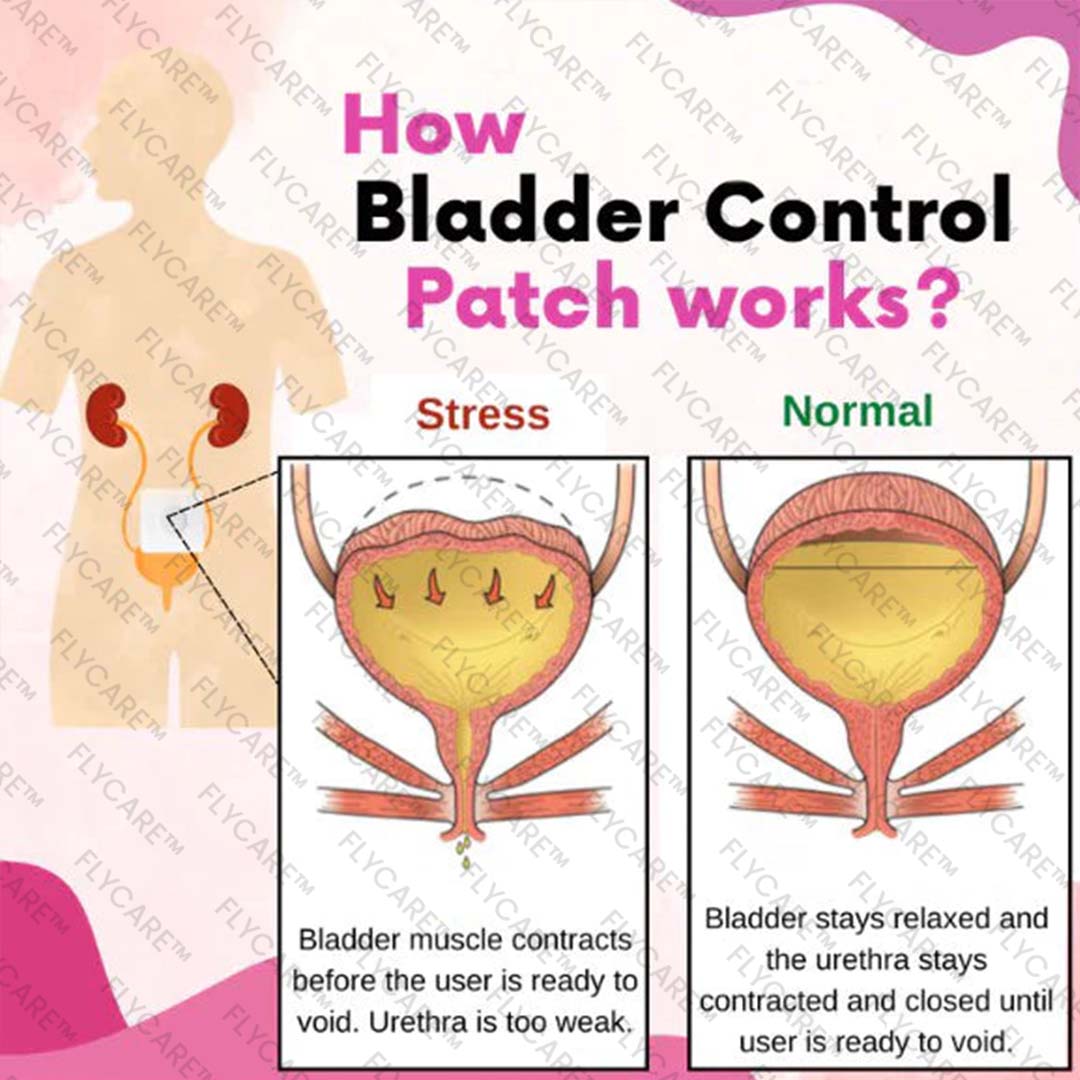 FLYCARE™ Bladder Control Anti-Incontinence Patch