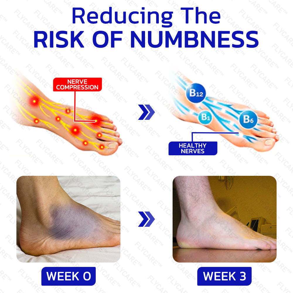 FLYCARE™ NumbFix Hands and Foots Spray