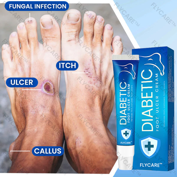 FLYCARE™ Diabetic Foot Ulcer Cream