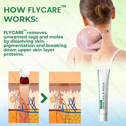 FLYCARE™ Skin Tag & Mole Removal Cream