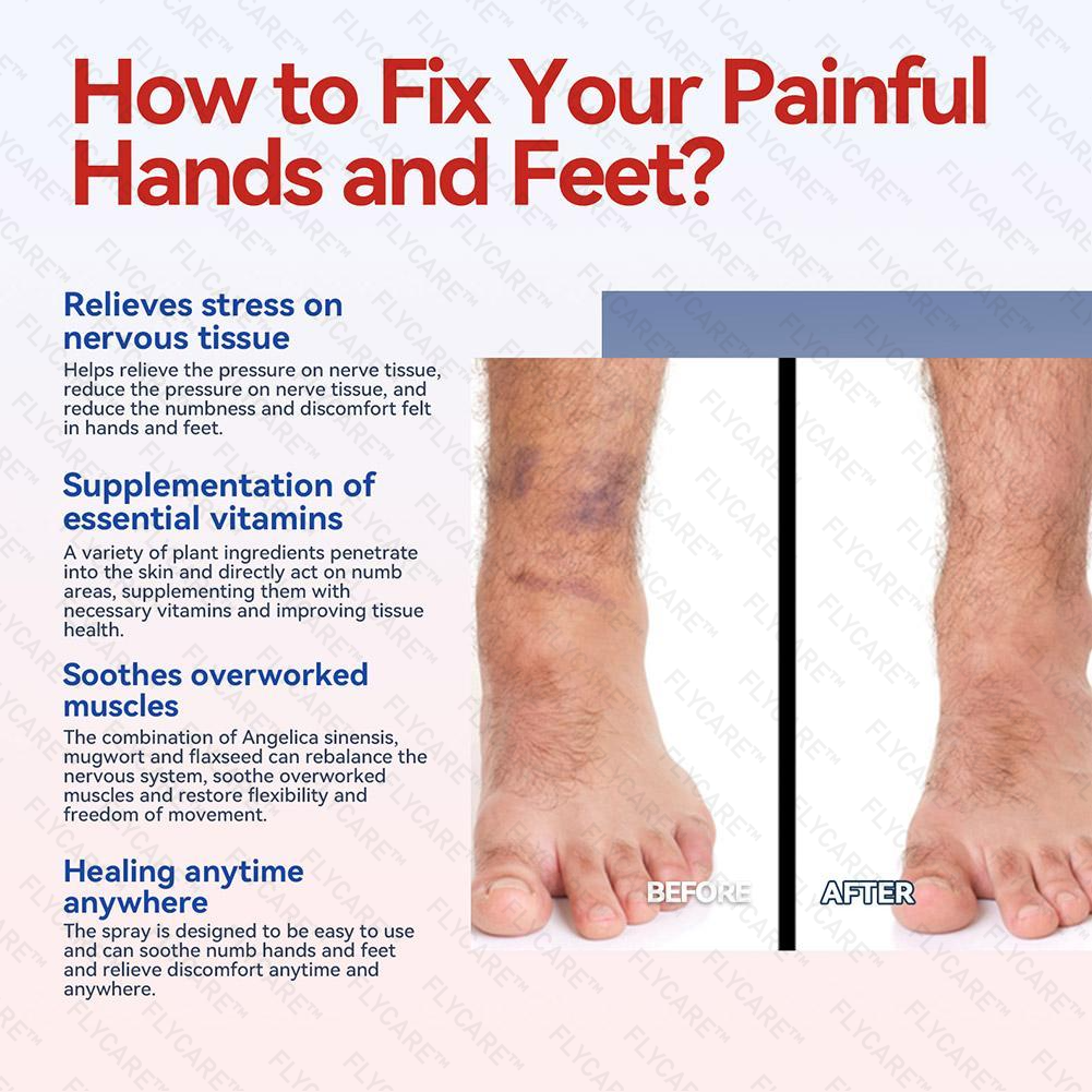 FLYCARE™ NumbFix Hands and Foots Spray